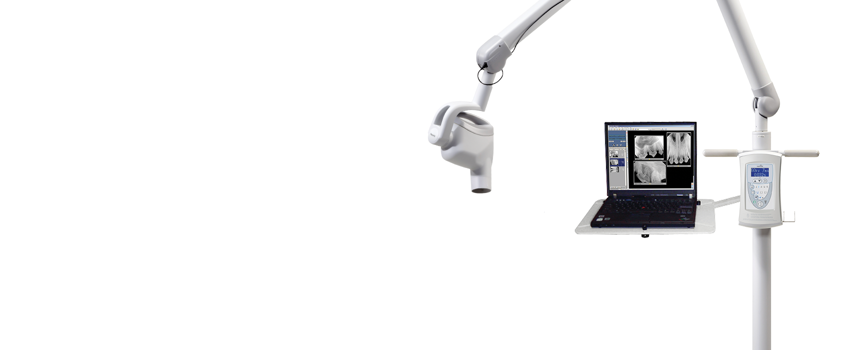 digital-dental-x-ray-V6