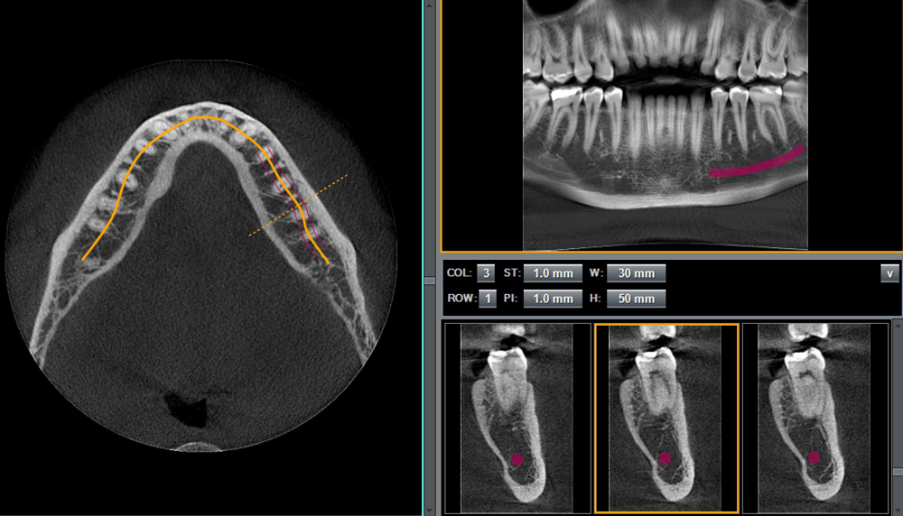 9x10-with-pan-and-nerve