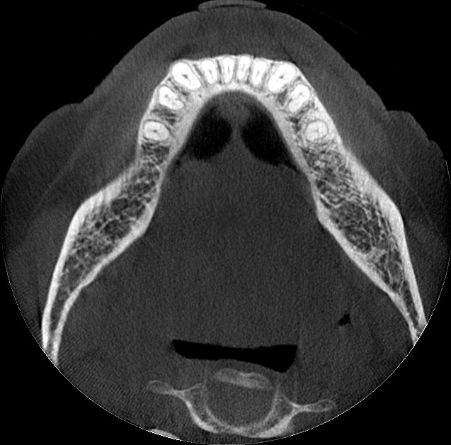 EOIS-9x10-Mandible