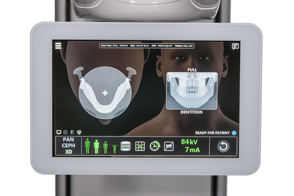 EOIS-CEPH-Display-Lateral-Left_3d-software-screen