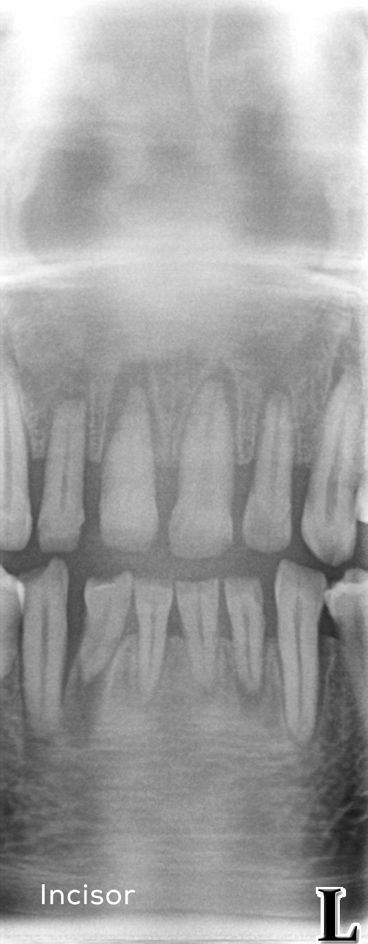 Incisor-full
