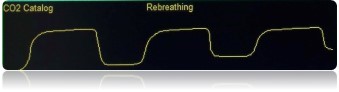 Using Capnography-wave forms
