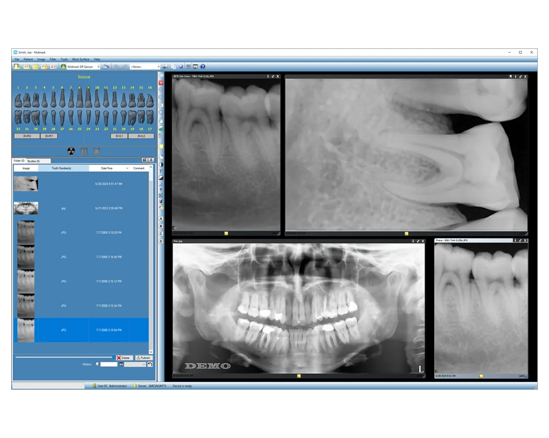 Progeny Imaging