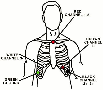 5-lead hookup