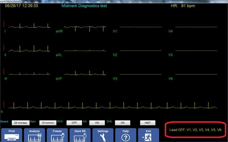 ChestLeadsOff800zz ChestLeadsOff800zz