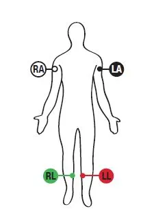 body diagram