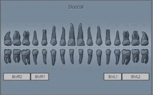 tooth-panel