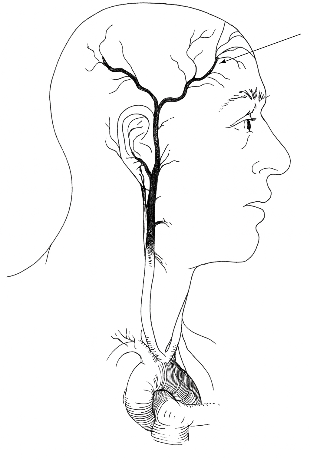 Frontal branch of the superficial temporal artery